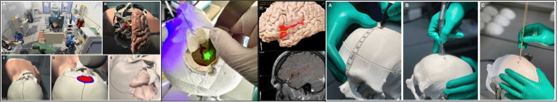 AG Neyazi_KCHN_UMMD_3